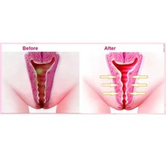 3pcs Natural Herbal Detox Pearls for Women FREE +1 Applicateur