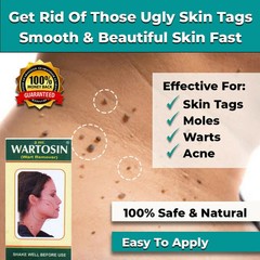NEW SKIN TAG REMOVER CREAM SAFE FAST WART REMOVAL MOLE ACNE PIMPLE PATCH SPOT UK