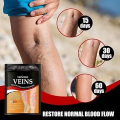 60 Pcs Varicose Veins Patches Relieve Pain Reduce Swelling Blood Circulation