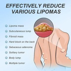 Discomfort Lipoma Soothing Cream Instant Ointment Relieving 20g Fat-Agglo Sell