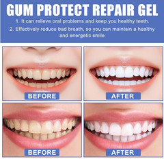 3Pcs Gum Protect Dental Repair Gel, Deep Cleaning Oral Gel, Fresh Breath Support