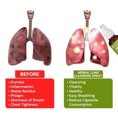 BreathDetox Lung Health – Lung Purify & Detox For Respiratory Support Sell 2024