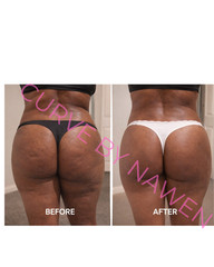 Booty & Hips Enhancement Gummies, Waist Slimming & Appetite Suppressant