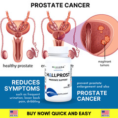 HALLPROST – Inflamed Prostate – Prostatitis – BPH – Urinary Function – 60 Cap