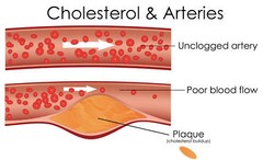 metabolism advantage – CHOLESTEROL RELIEF – cholesterol reduction complex – 3 B