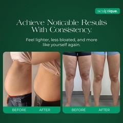 Sculptique Lymphatic Drainage Supplement – Lymphatic Drainage Capsules with D…