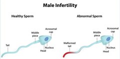 FERTILIDAD MASCULINA – AYUDA A LA CONCEPCIÓN – AUMENTO DE LA MOVILIDAD SEMINAL