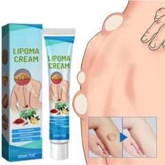 Discomfort Lipoma Soothing Cream Instant Ointment Relieving 20g Fat-Agglo Sell