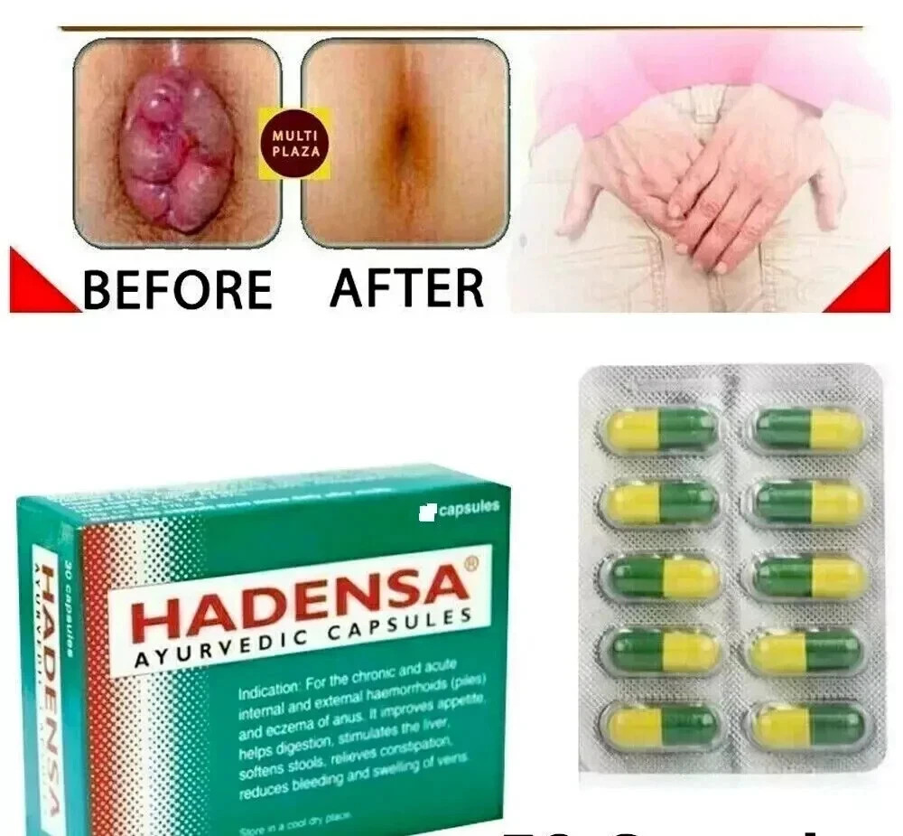 Hadensa Ayurvedic Hemorrhoids & Piles Pain Relief Itching Swelling 20 Pills