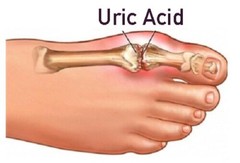 tart cherry extract – Uric Acid Formula 1430mg – gout relief vitamins 1 Bottle