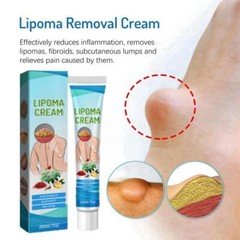 Discomfort Lipoma Soothing Cream Instant Ointment Relieving 20g Fat-Agglo Sell