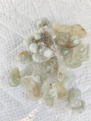 4 oz genuine Hojari Green frankincense 1/4lb – Ethically sourced from Oman