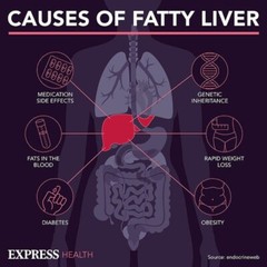 FATTY LIVER HUMAN DETOX CLEAN & REMOVE FAT – TREAT PREVENT – MADE IN USA
