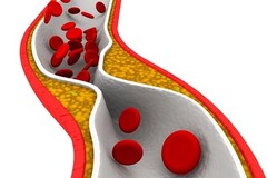 Heart Health-CHOLESTEROL RELIEF-Causes significant decrease of Cholesterol – 120
