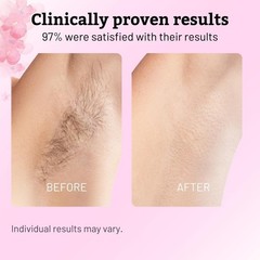 Cyperus Rotundus Oil – 60ml Natural Cyperus Rotundus Oil For Hair Removal, Mo…