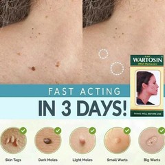 3x NEW SKIN REMOVER CREAM SAFE FAST WART REMOVAL MOLE ACNE PIMPLE PATCH SPOT US