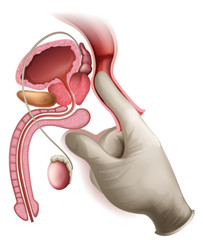 PRODUCTO NATURAL PARA LA PROSTATA