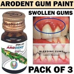 Arodent Gum Paint – Ayurvedic Remedy for Gingivitis, Bleeding Gums, Oral Ulcers