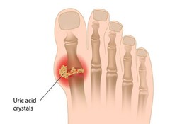 relieve joint pain – Uric Acid Formula 1430mg 3B – milk thistle herbs for health